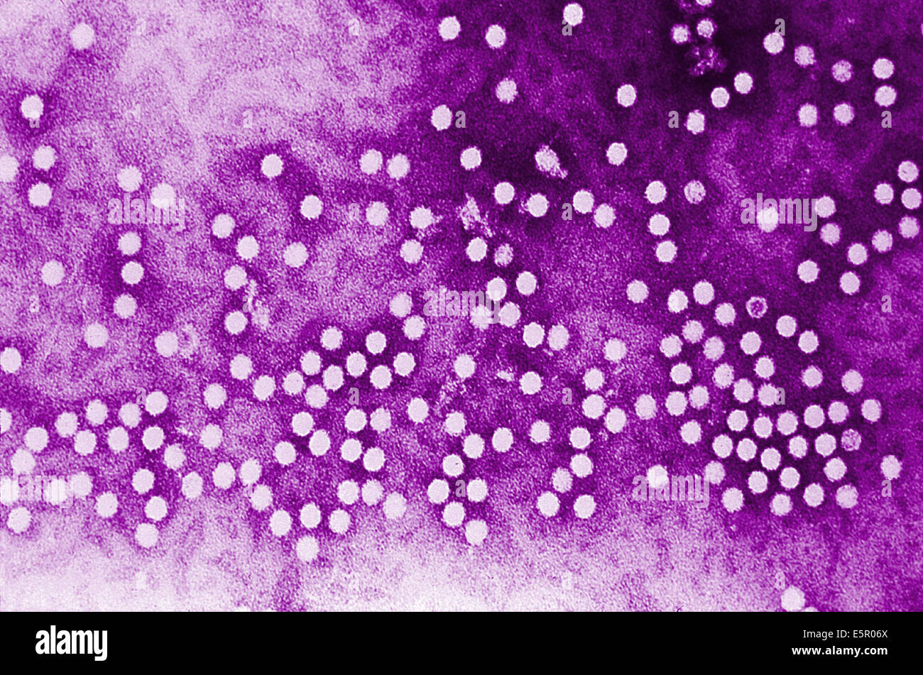 Elektron Schliffbild des Parvovirus h-1 Virionen der Parvoviridae Familie von DNA-Viren. Stockfoto