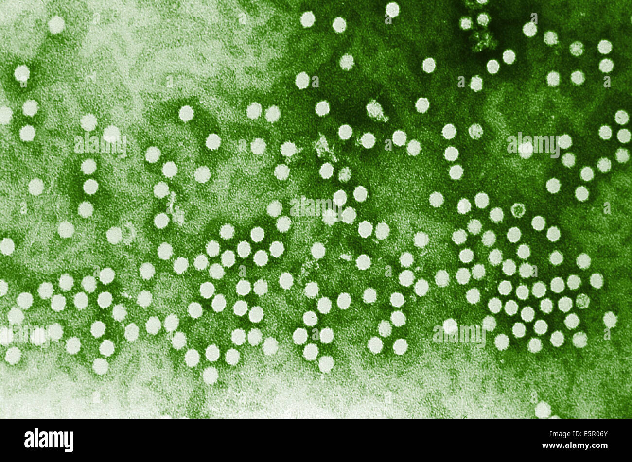 Elektron Schliffbild des Parvovirus h-1 Virionen der Parvoviridae Familie von DNA-Viren. Stockfoto
