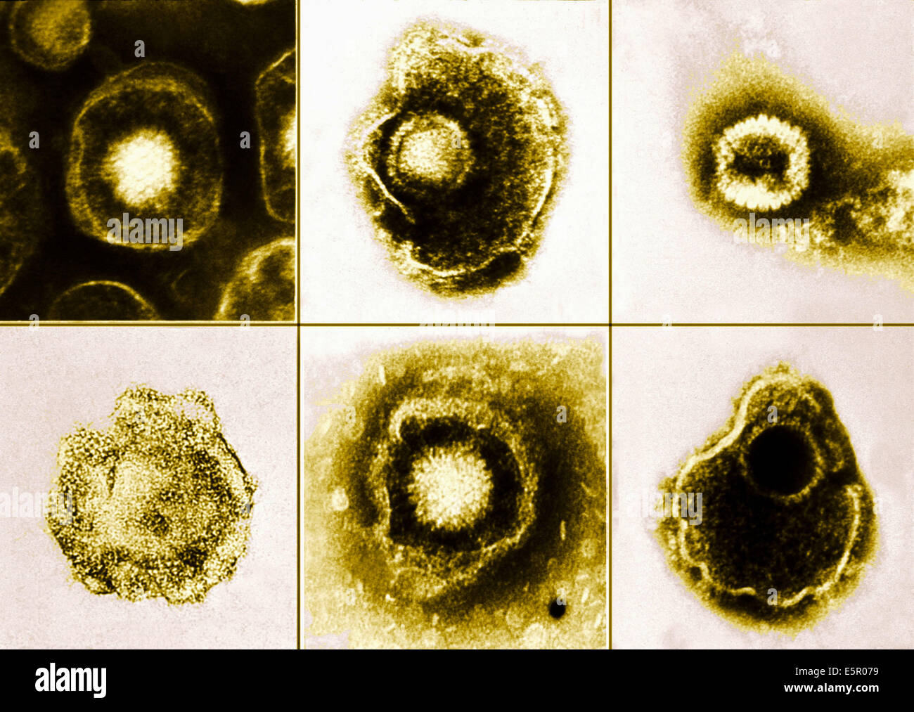 Elektron Schliffbild des Herpes-Simplex-Virus. Stockfoto