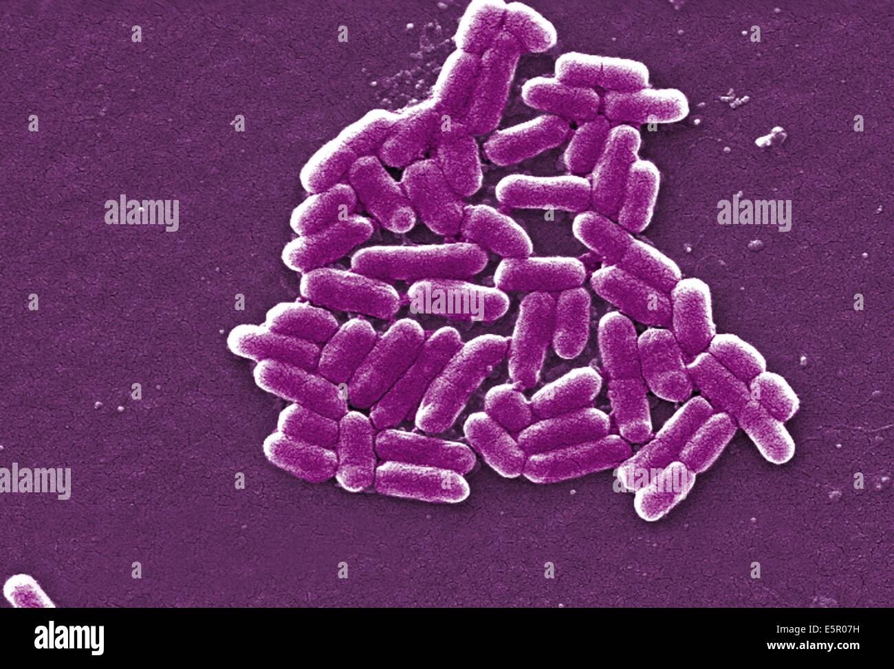 Escherichia coli bakterium Fotos und Bildmaterial in hoher Auflösung