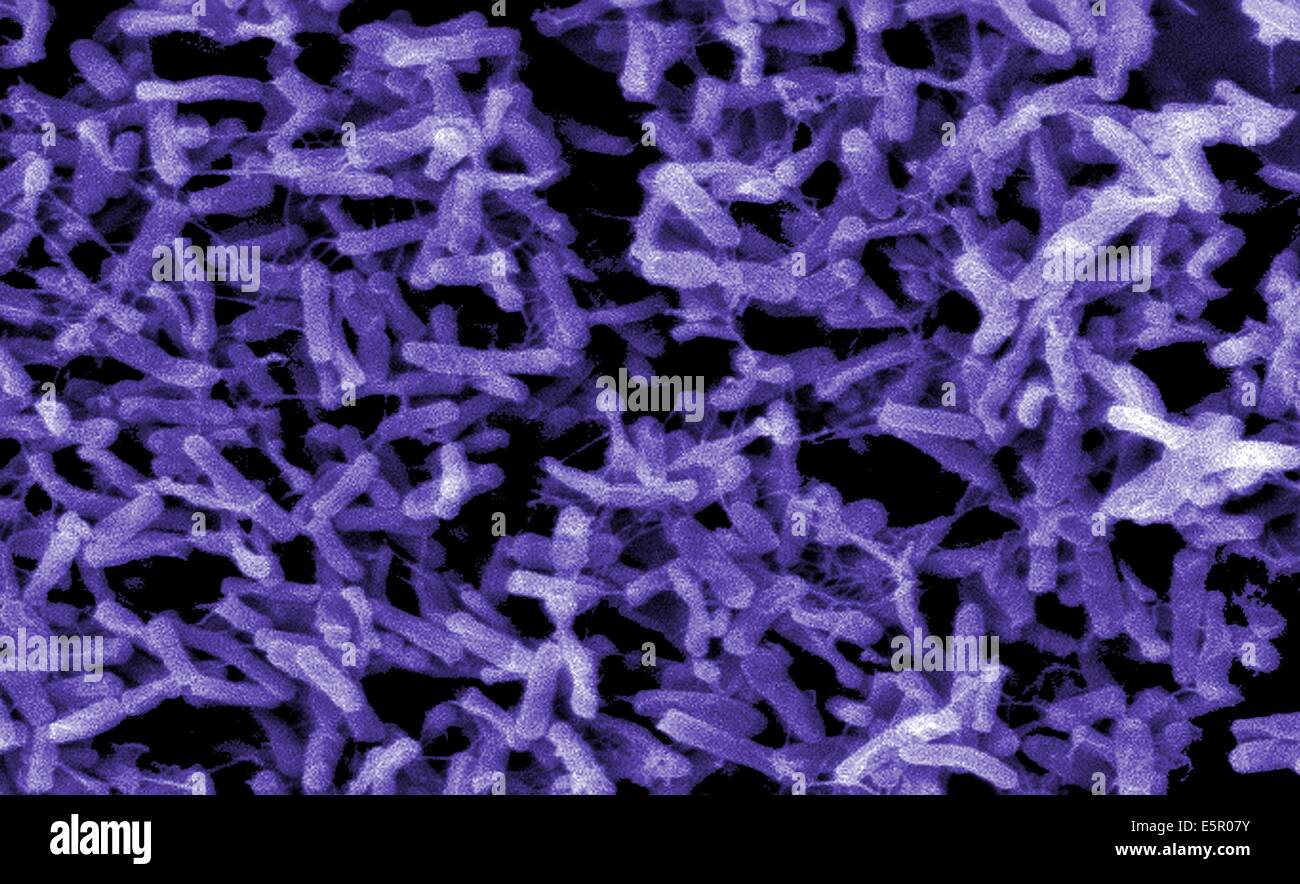 Elektron Schliffbild des Bakteriums Clostridium Difficile, diese anaeroben Gram-positiven Rute ist die häufigste Ursache für Stockfoto