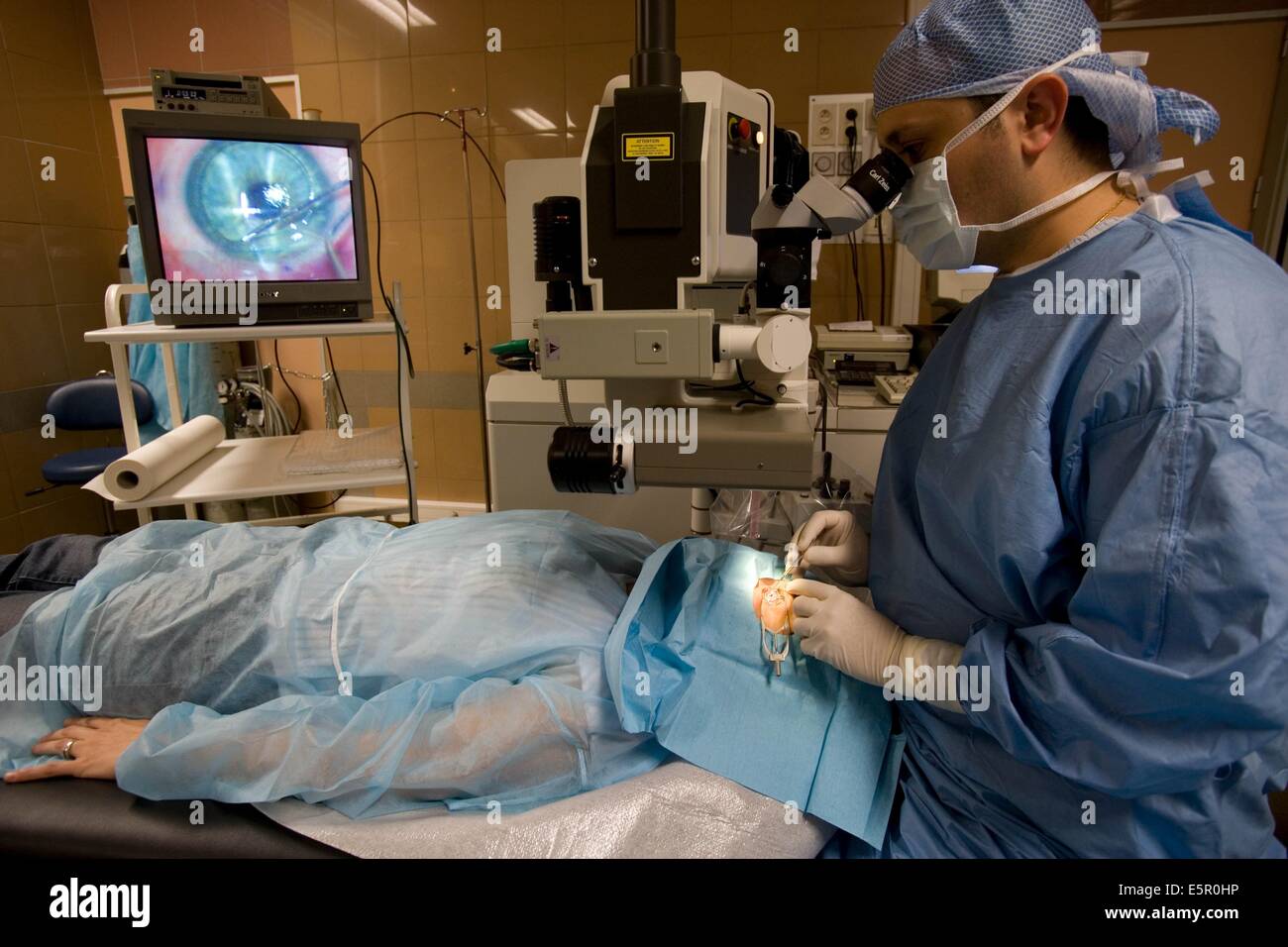 LASIK (Laser Assisted Intrastromal Keratomileusis), besteht diese Operation bei der Schaffung einer Klappe auf der Oberfläche der Hornhaut mit Stockfoto