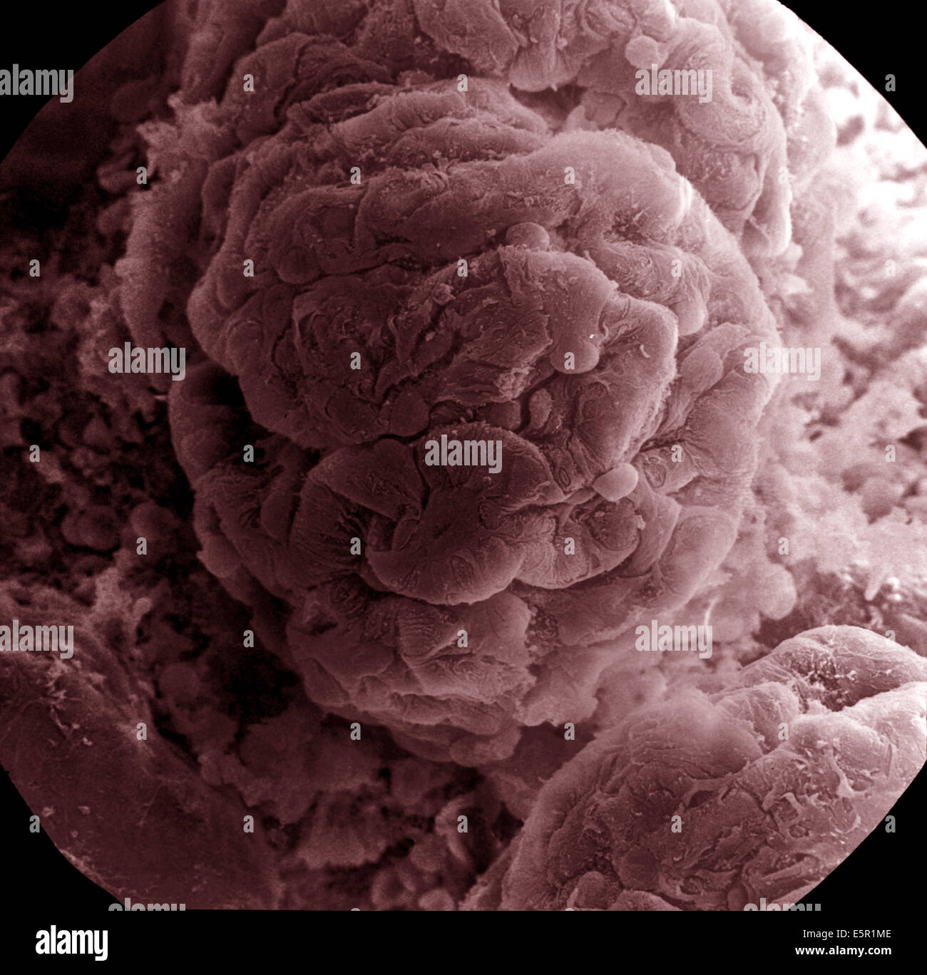 Scanning Electron Schliffbild (SEM) von einem Glomerulus auf der Oberfläche, die Auswirkungen der Podocytes, die das Blut filtern Stockfoto