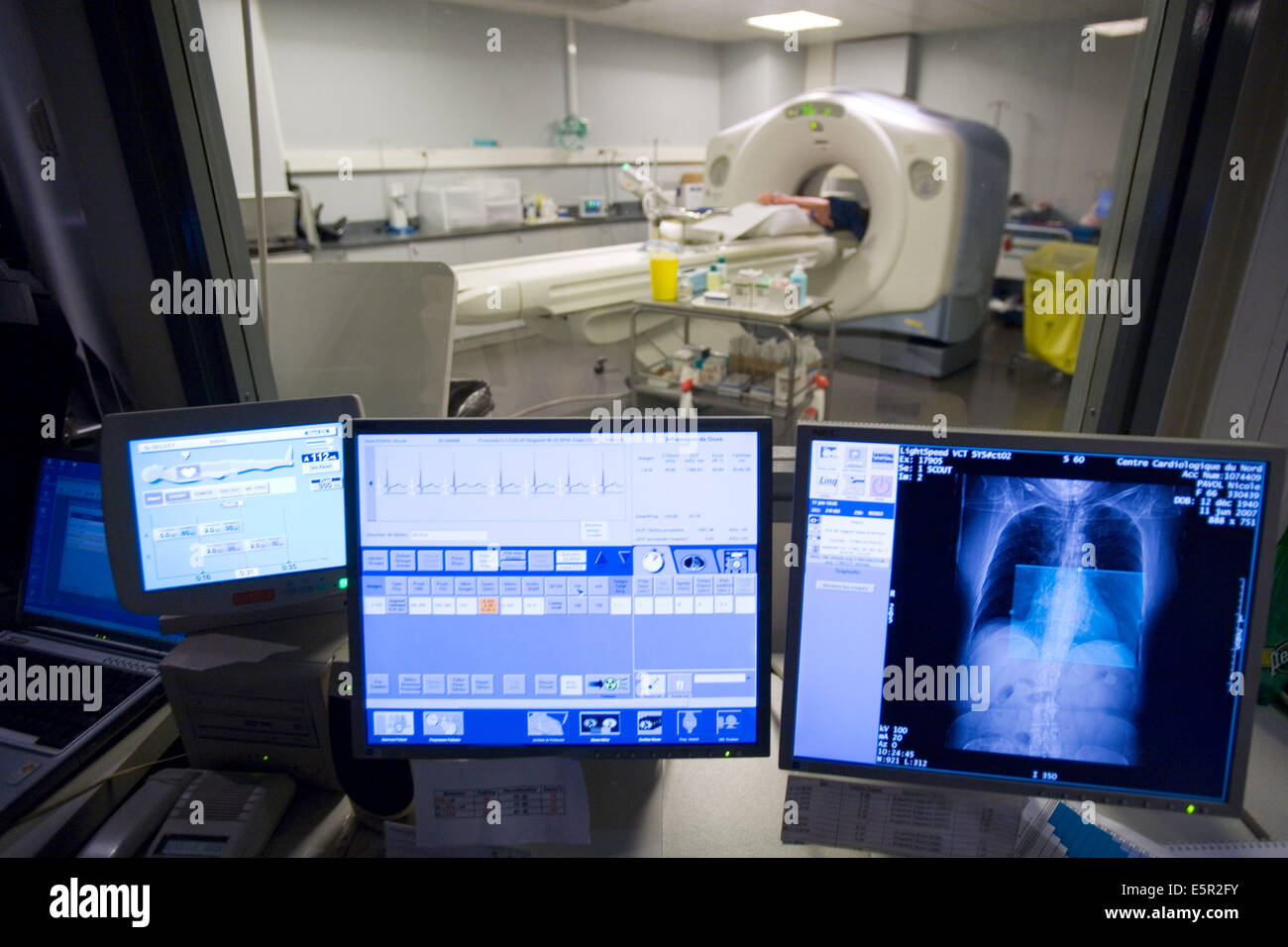 Patienten Herz 3D CT-Scan, Department of Medical Imaging, Zentrum Cardiologique du Nord, Saint-Denis, Frankreich. Stockfoto