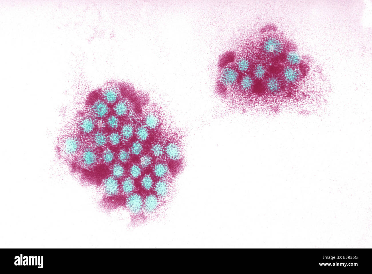 Elektron Schliffbild des Norwalk Virus, ein RNA-Virus der Gattung Norovirus (Caliciviridae) verantwortlich für Gastroenteritis. Stockfoto