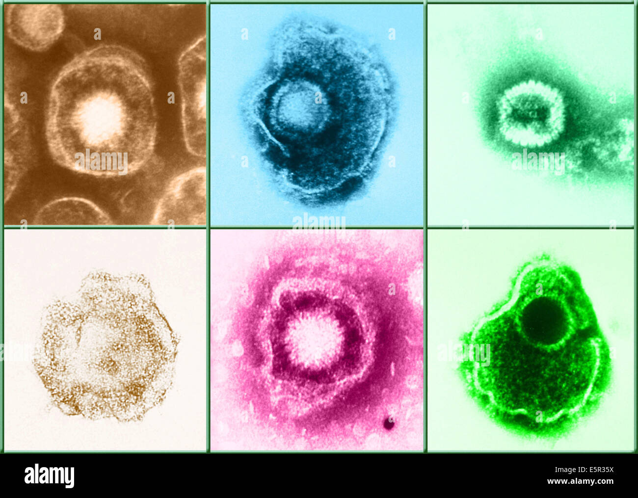 HerpesSimplexVirus (HSV) ist eine Virusinfektion,