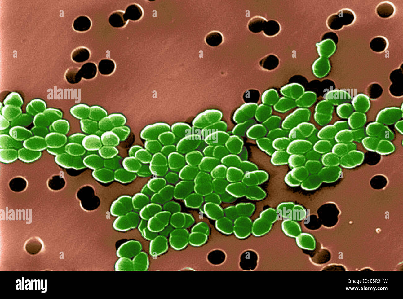 Farbe verstärkt scanning Electron Schliffbild von Vancomycin resistente Enterokokken (VRE). Stockfoto