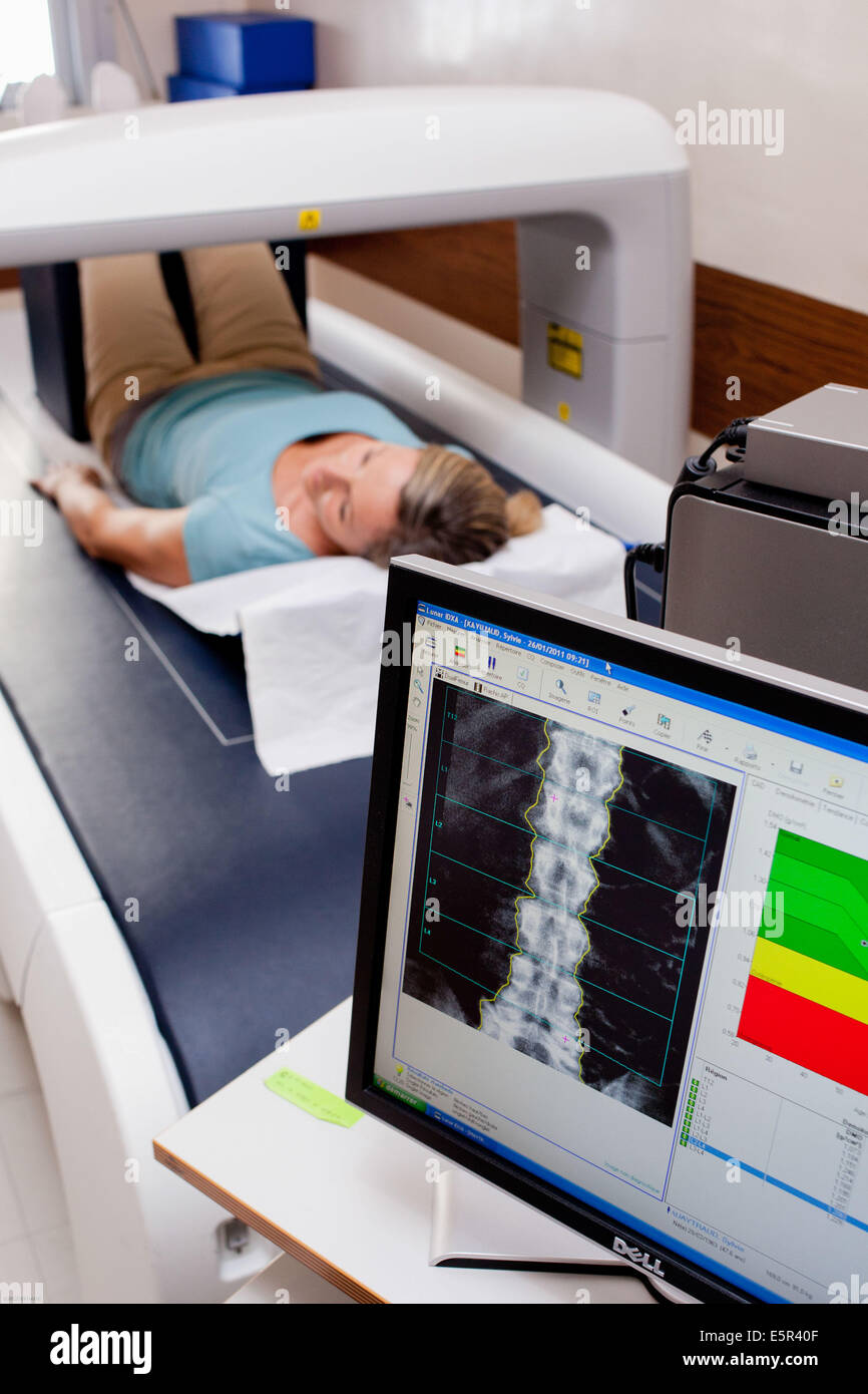 Messung der optischen Dichte der unteren Rachis (Backbone) der Patientin zur diagnose von Osteoporose Knochendichtemessung. Stockfoto