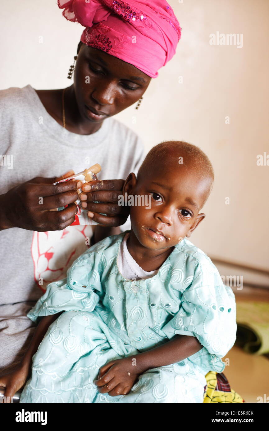 Appetit-Test: Frau geben Sie ihrem Kind eine Ration Plumpy nut, Erdnuss-basierte therapeutische Nahrung Programm zur ambulanten Behandlung von Stockfoto