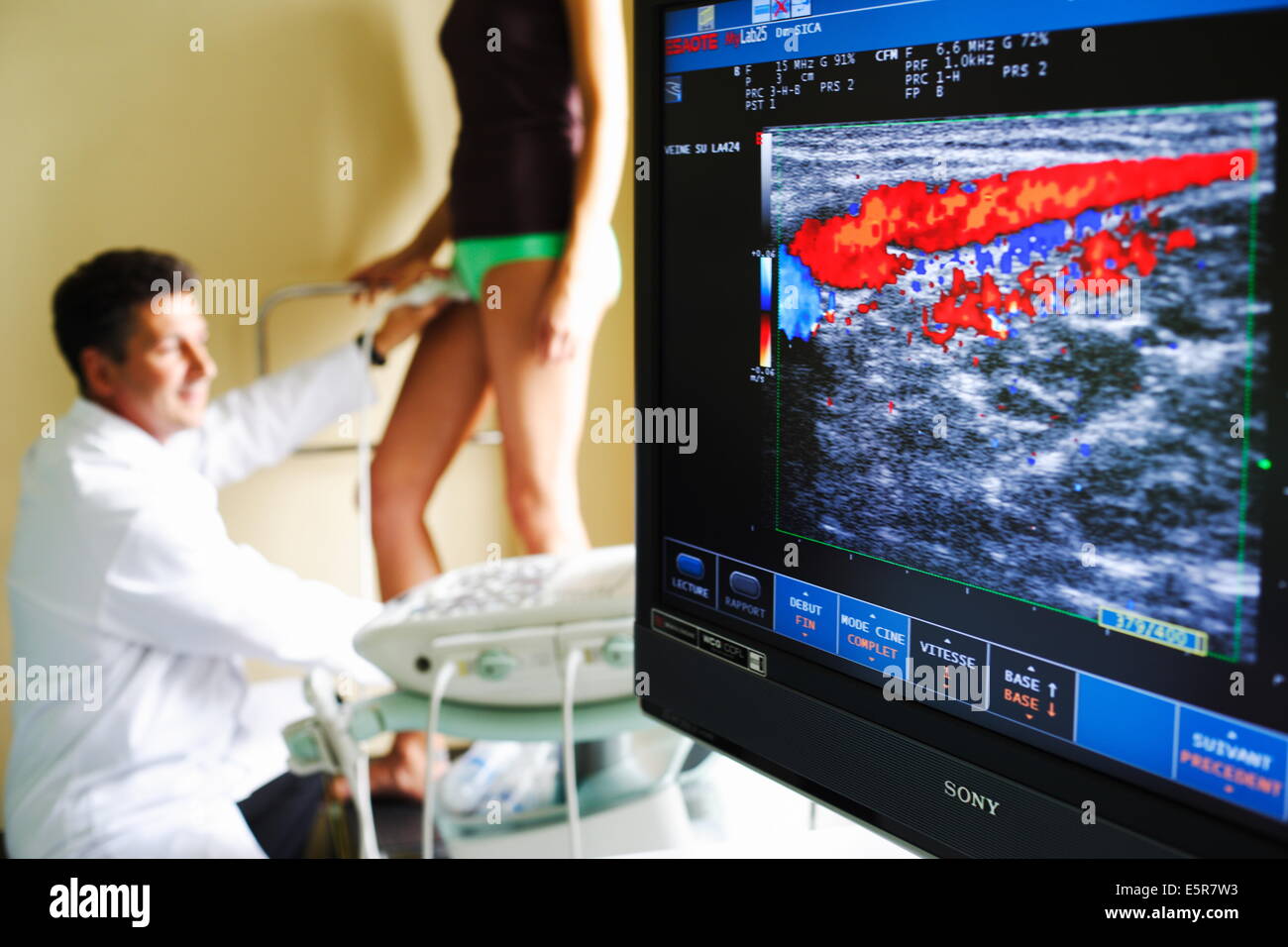 Doppler Untersuchung Beine In Der Nähe www.alamy.de
