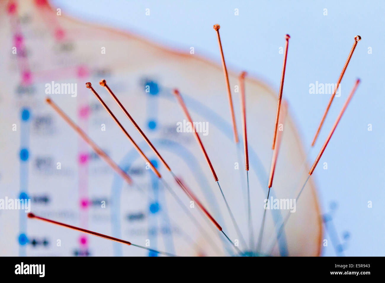 Akupunktur. Stockfoto