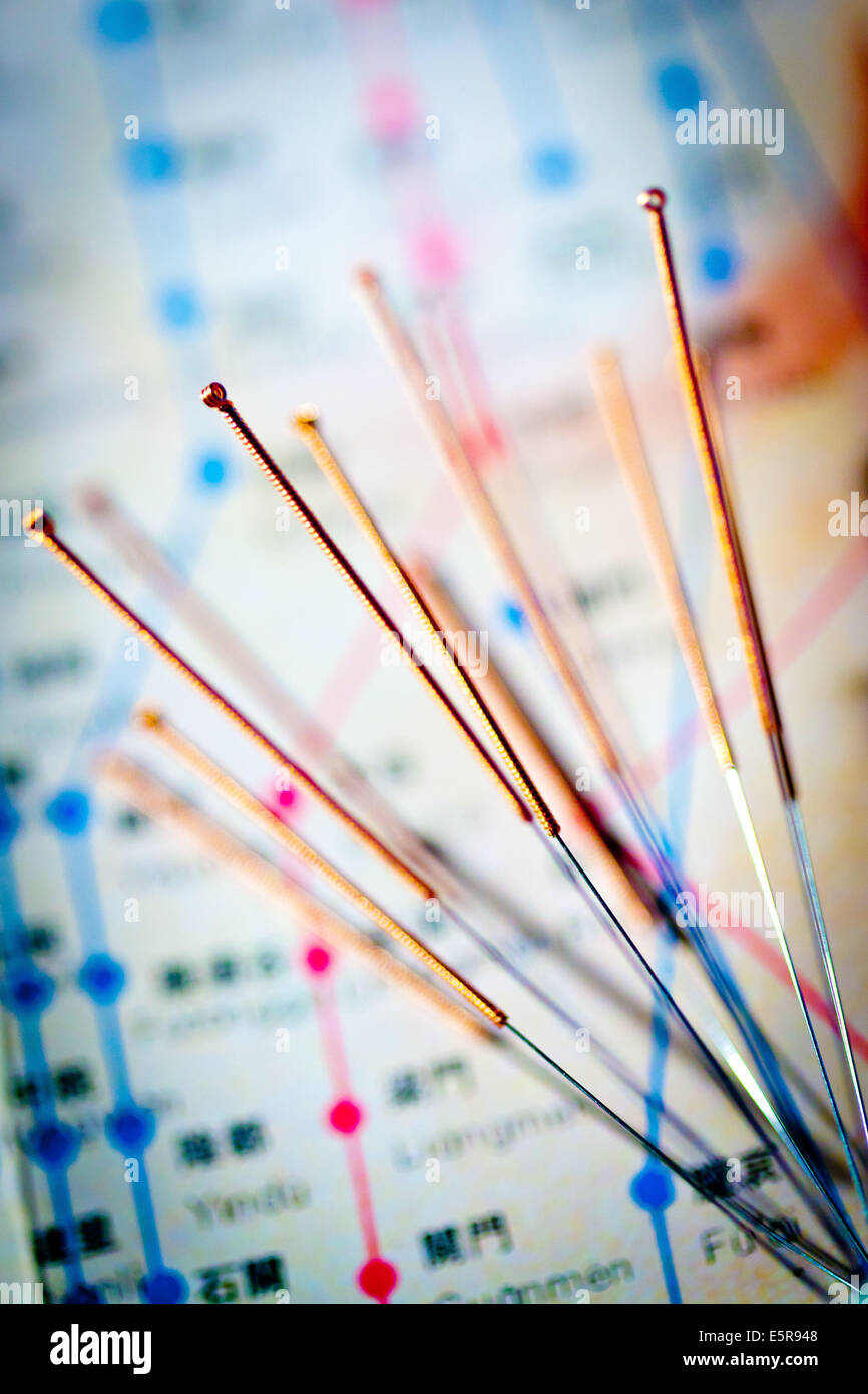 Akupunktur. Stockfoto