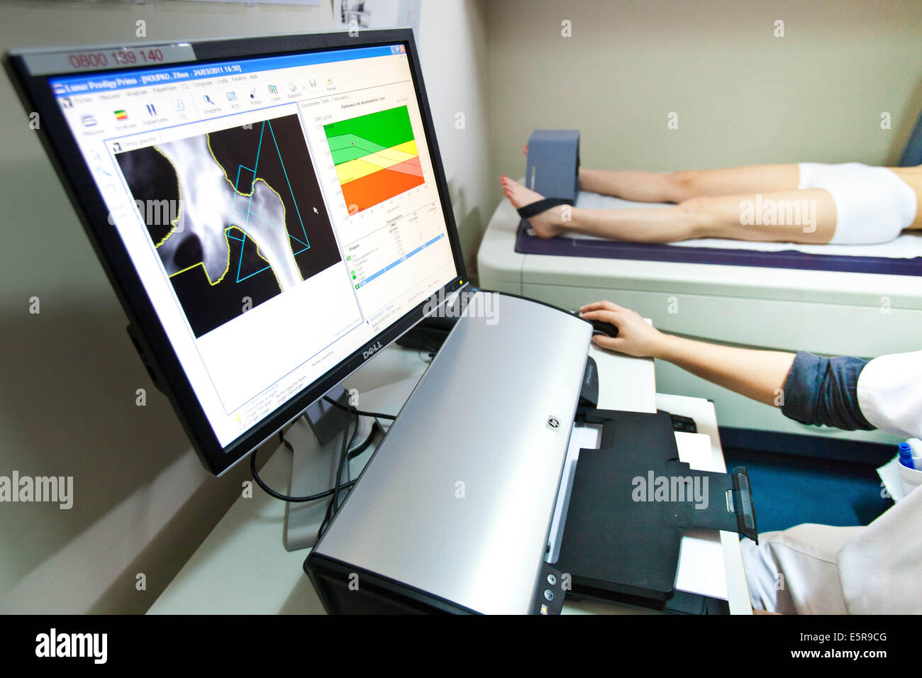 Ein Arzt benutzt ein Knochen Densitometer zur Messung der optischen Dichte des Halses des Oberschenkelknochens der Patientin zu diagnostizieren Stockfoto