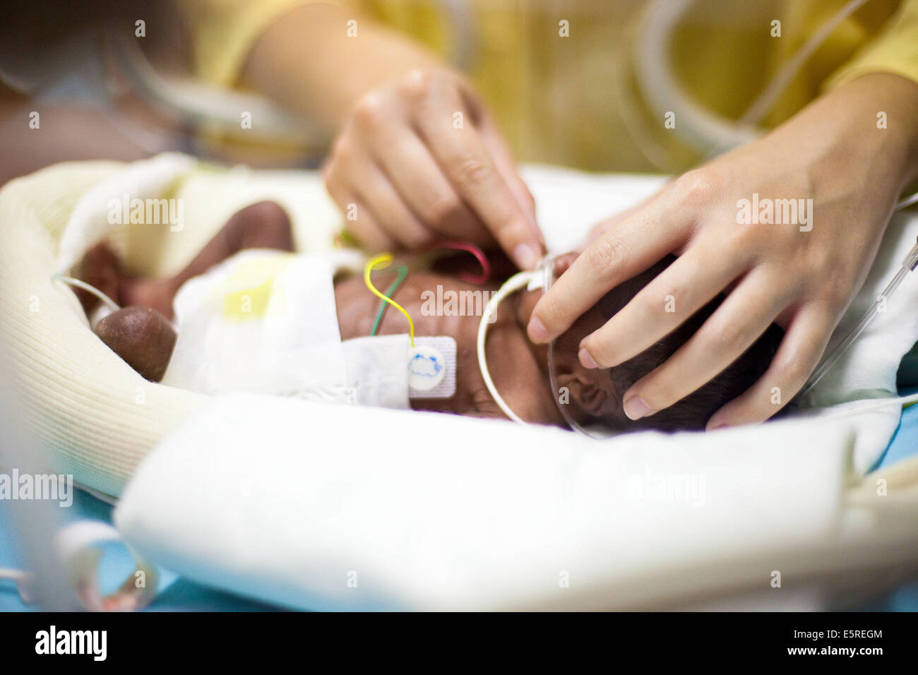 Vorzeitigen Neugeborenen platziert unter Unterstützung der Atmung, Neonatalogy Abteilung, Robert Debre Krankenhaus, Paris, Frankreich. Stockfoto