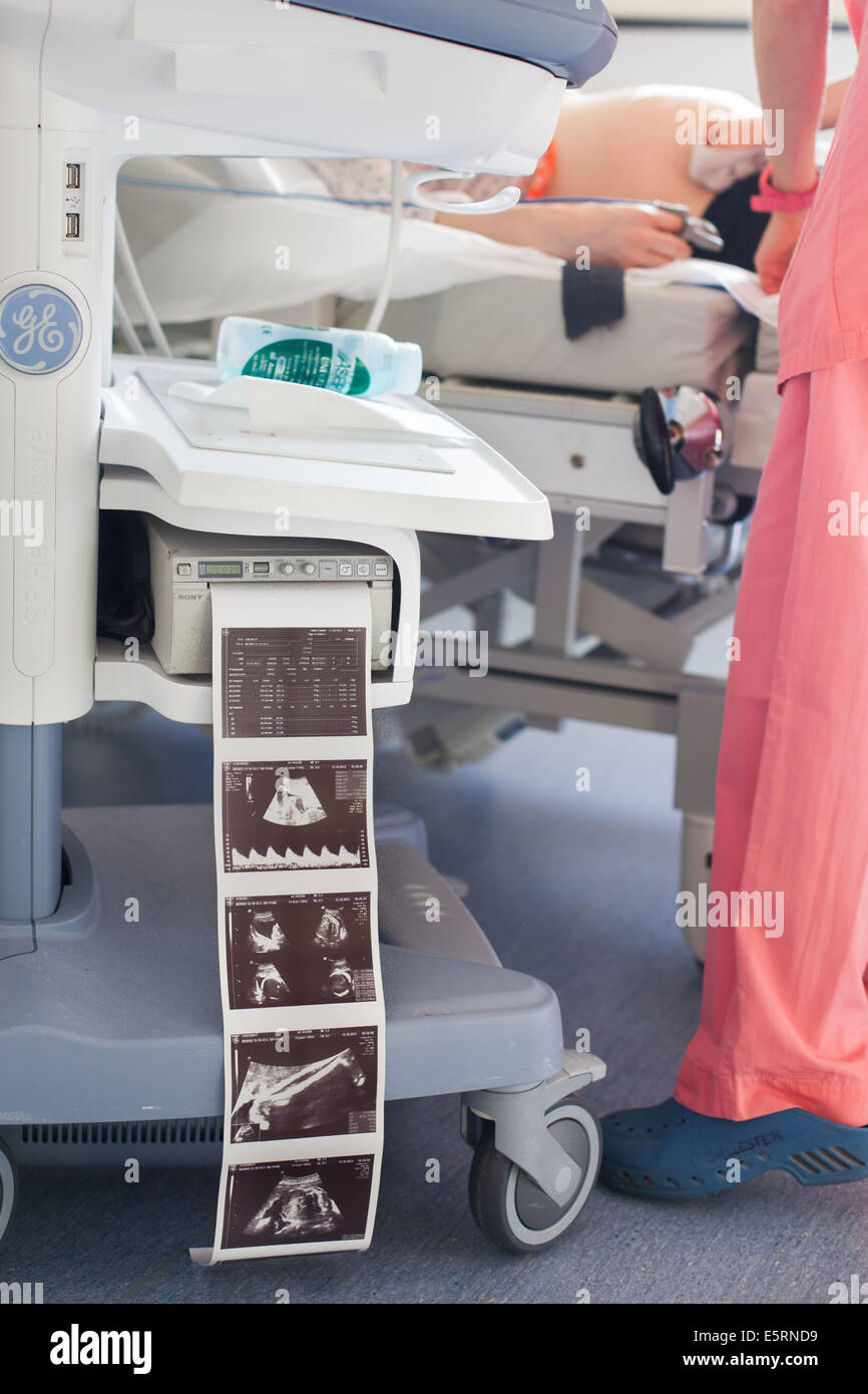 8 Monate schwangere Frau durchmachenden fötale Ultraschalluntersuchung von Gynäkologen durchgeführt. Abteilung für Geburtshilfe und Gynäkologie Stockfoto