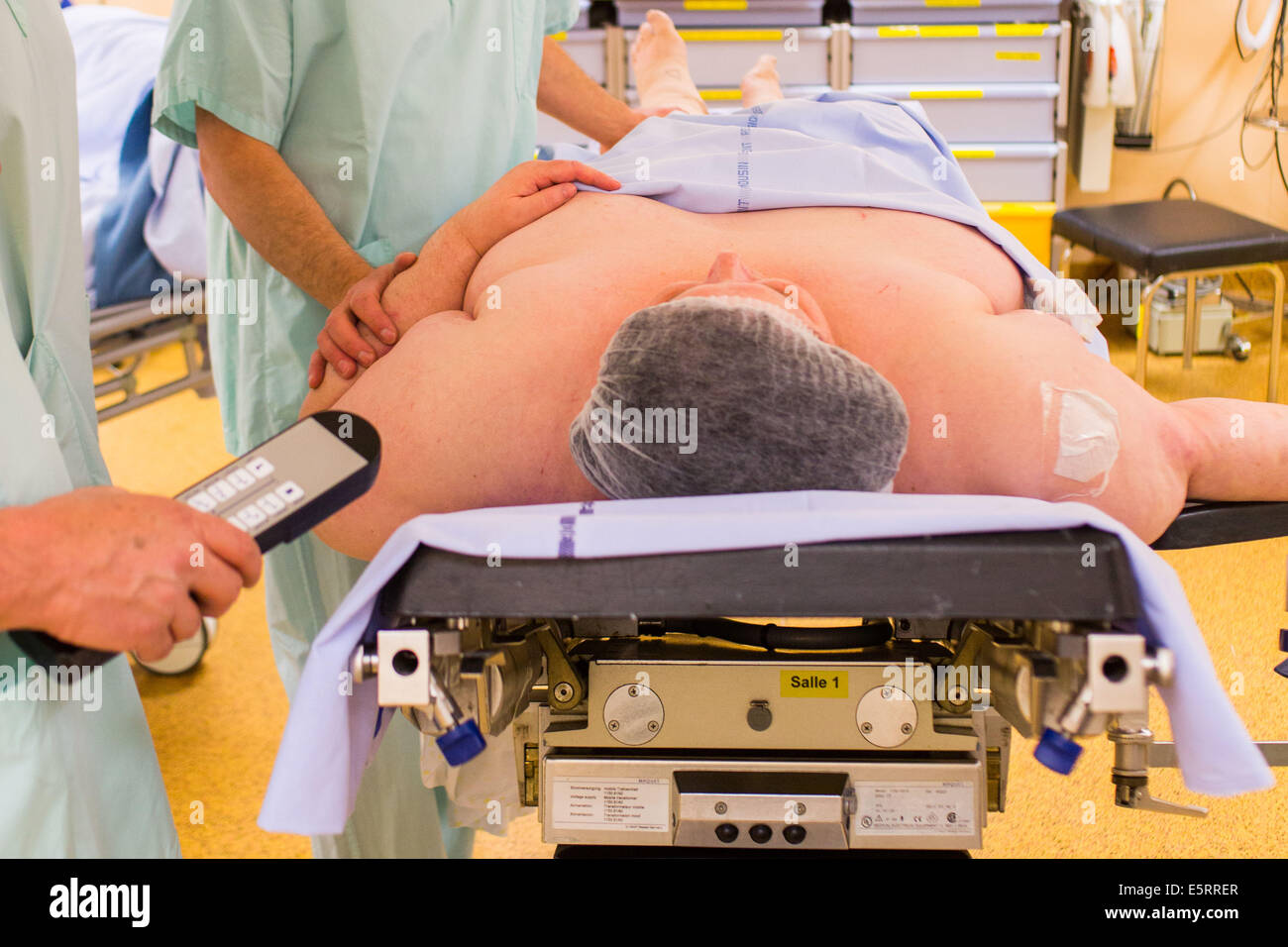 Adipösen Patientin vor der laparoskopischen Sleeve-Gastrektomie, Limoges Krankenhaus. Stockfoto