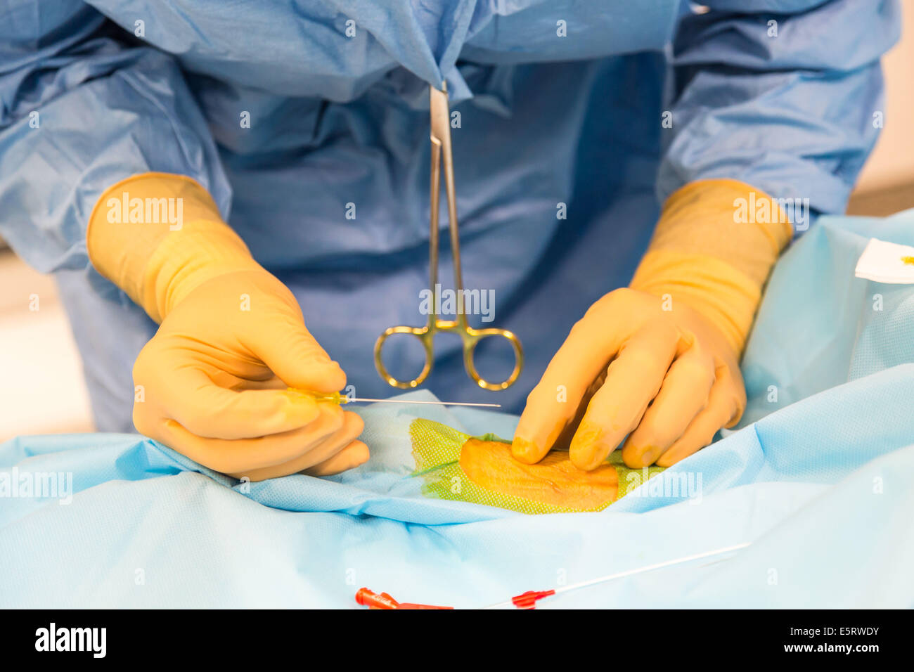 Intern setzt einen Katheter in der radialen Arterie, Intensivpflege Abteilung, Krankenhaus Lagny Marne-la-Vallée, Frankreich, Stockfoto