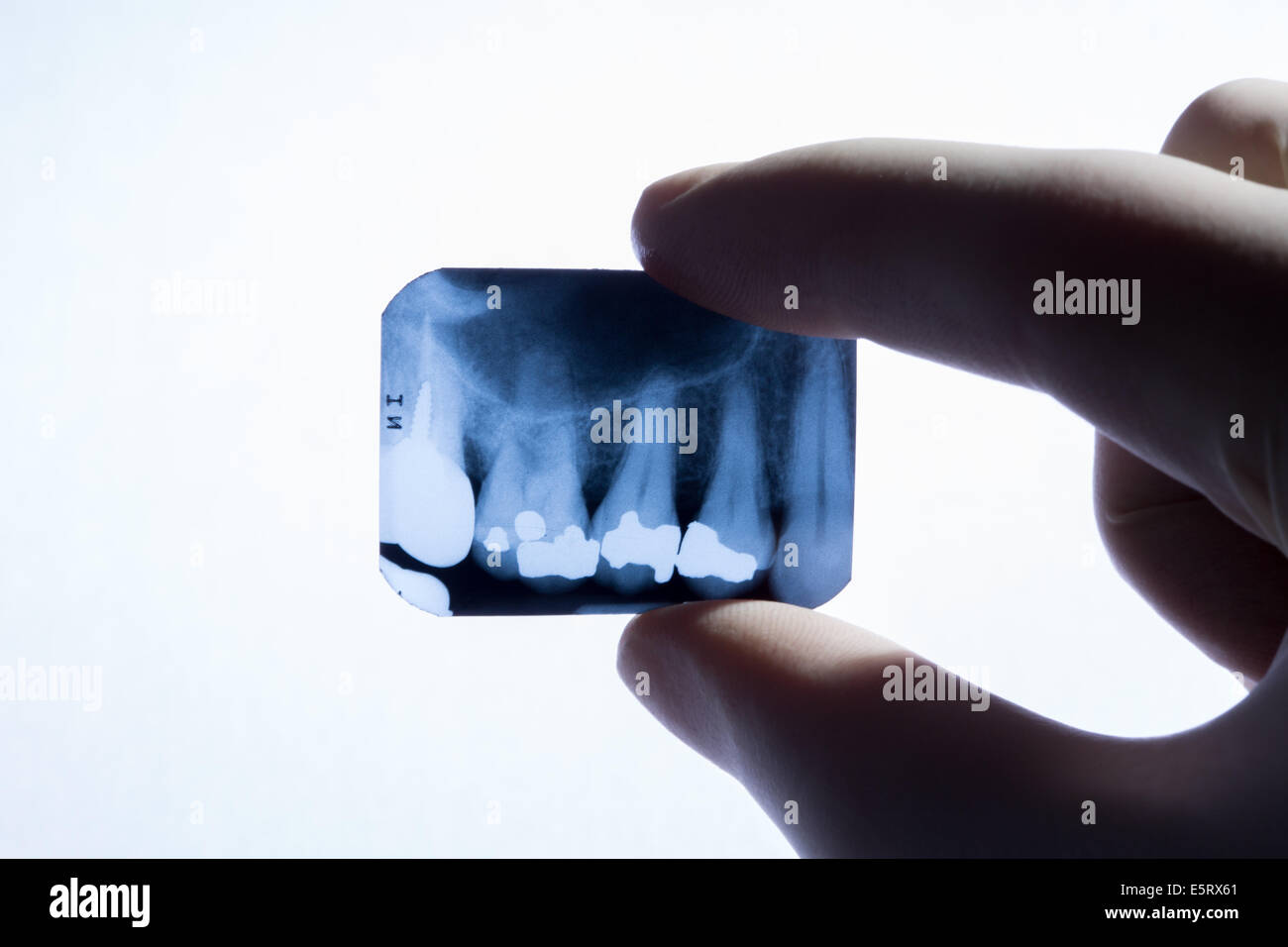 Röntgen der Zähne Stockfoto