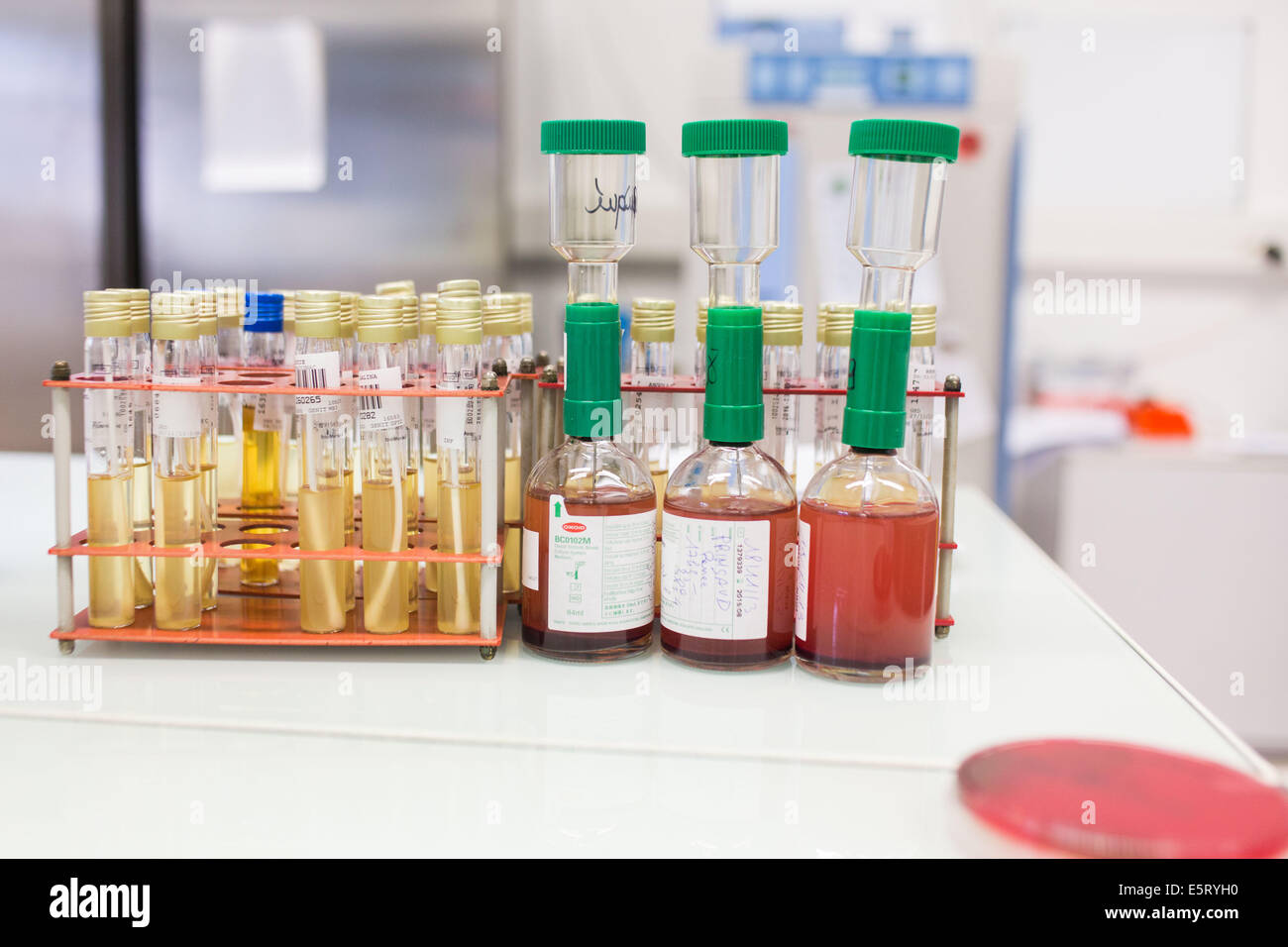 Bakterielle und mykologische Kulturen in einem medizinischen Labor. Stockfoto