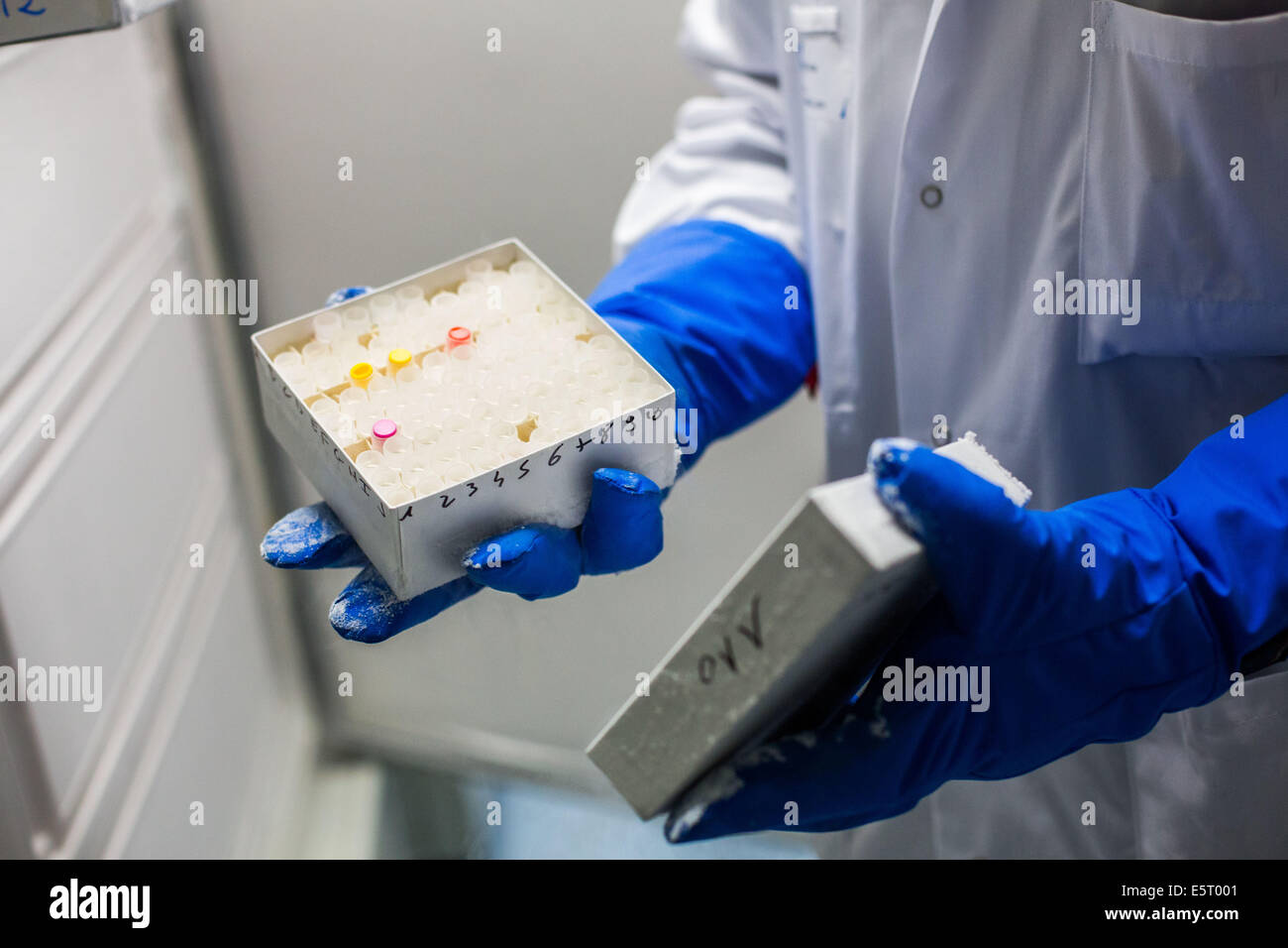 Kryokonservierung von Tumorproben, Tumor Bank Tenon Hospital, Paris, Frankreich. Stockfoto