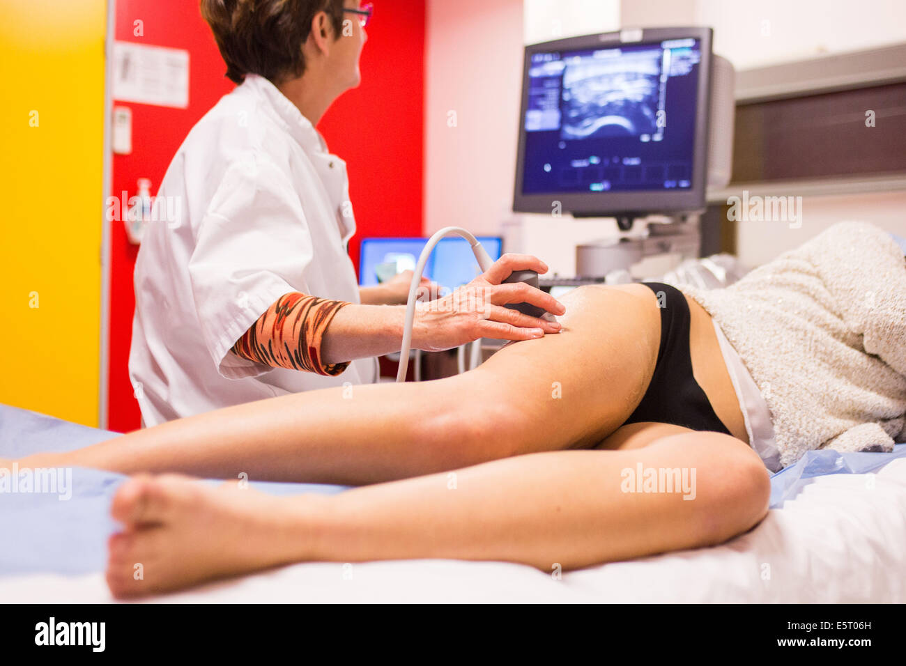 Weibliche Patienten einen doppler-Ultraschall (Angiodynography) Scannen an den unteren Extremitäten, Angoulême Krankenhaus, Frankreich. Stockfoto