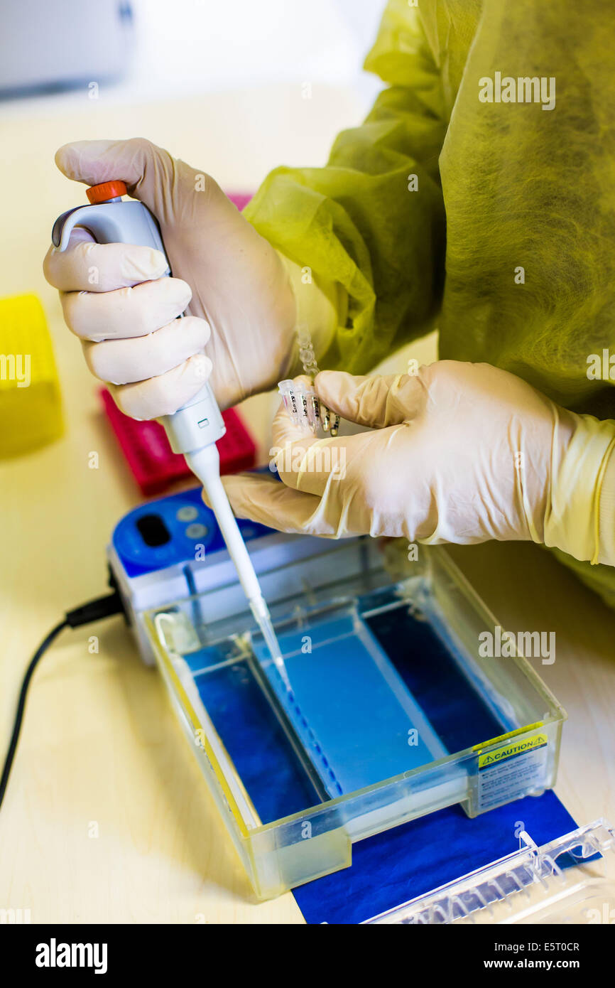 Resarcher Antragsteller Hepatitis Virus genetisches Material für die Gewinnung von DNA durch Elektrophorese auf einem Gel, Labor des Zentrums Stockfoto