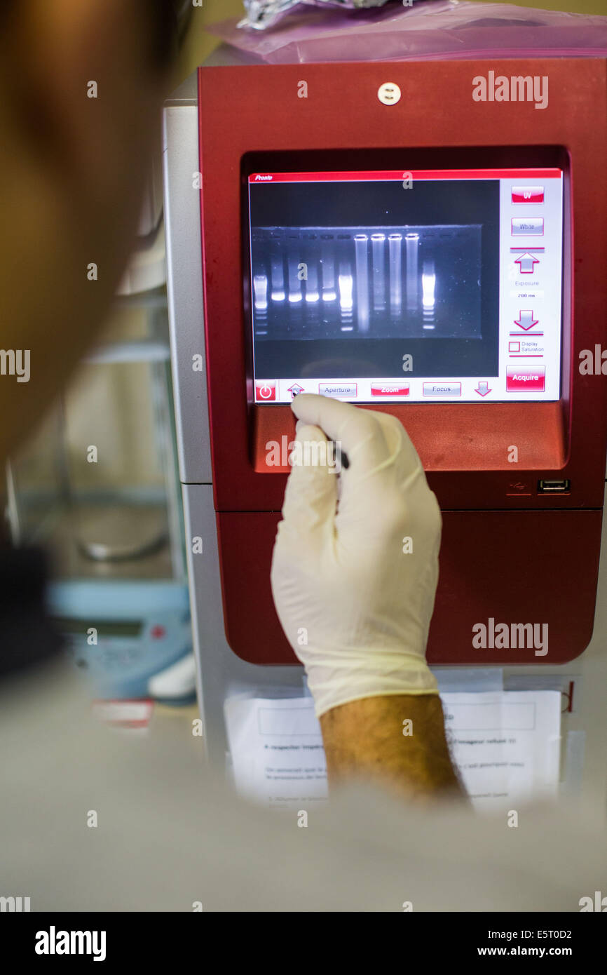 Forscher untersuchen die gebänderten DNA-Sequenzen eines Hepatitis-Virus auf einem Autoradiogram Labor des Centre de Stockfoto