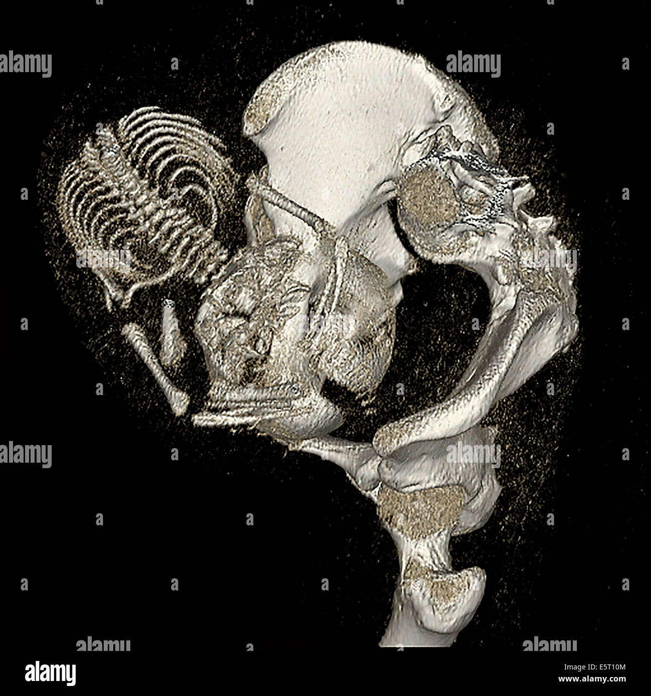 Dreidimensionale berechnete tomographische Rekonstruktion der schwangeren Frau Becken zeigt das Skelett eines 9 Monate alten Fötus, Stockfoto