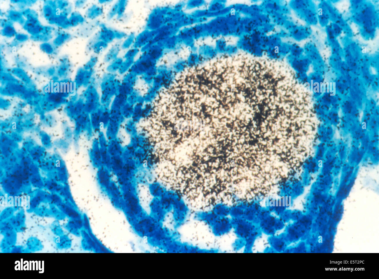 Leichte Schliffbild einer Maus Eizelle, die ein Onkogen (ein Krebs erregenden gen) ausdrückt. Die Technik zum Testen ihrer Stockfoto