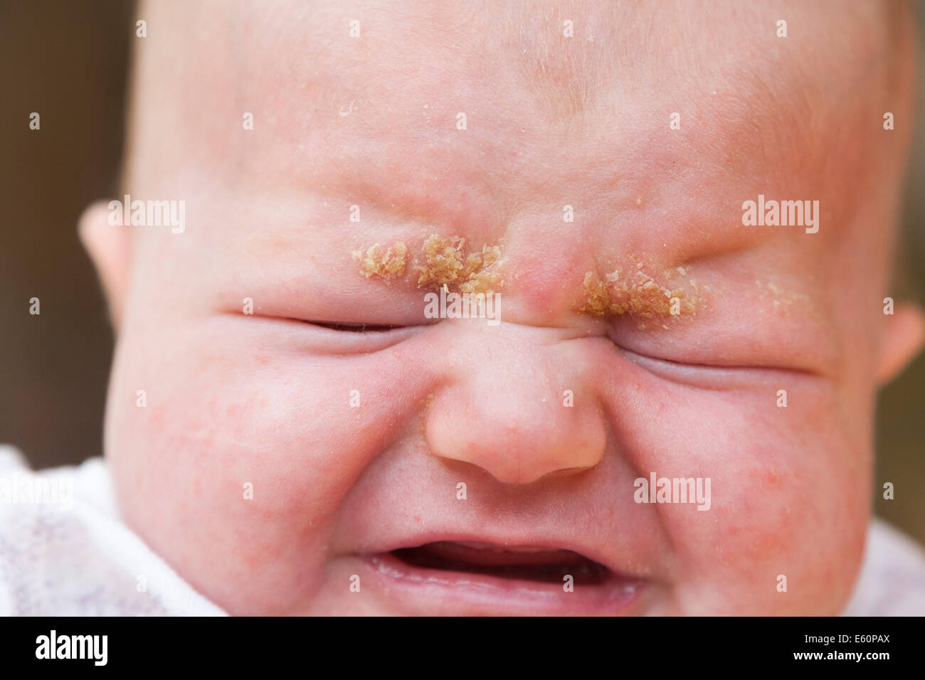 Ein drei Wochen altes Bucht mit Aufnahmevorrichtung Kappe auf den Augenbrauen. VEREINIGTES KÖNIGREICH. Stockfoto