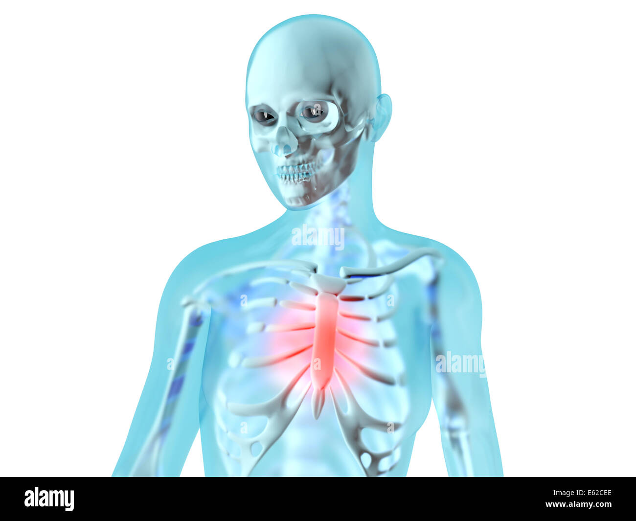 Weibliche Anatomie. Schmerzen in der Brust Stockfotografie Alamy