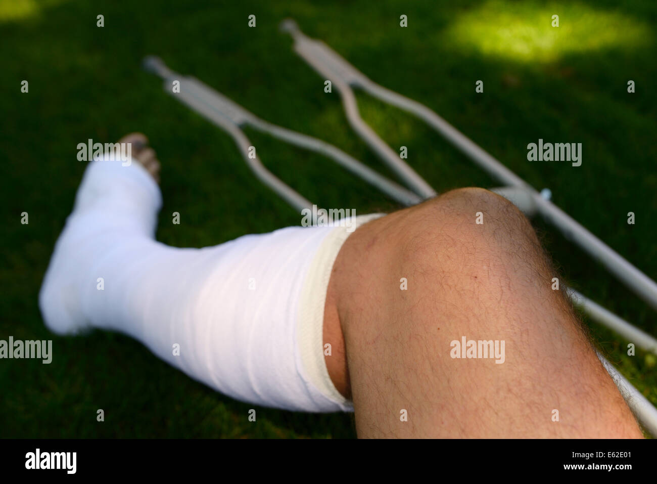 Verletzten Mann mit Bein in Gips und Krücken auf einer Wiese Stockfoto