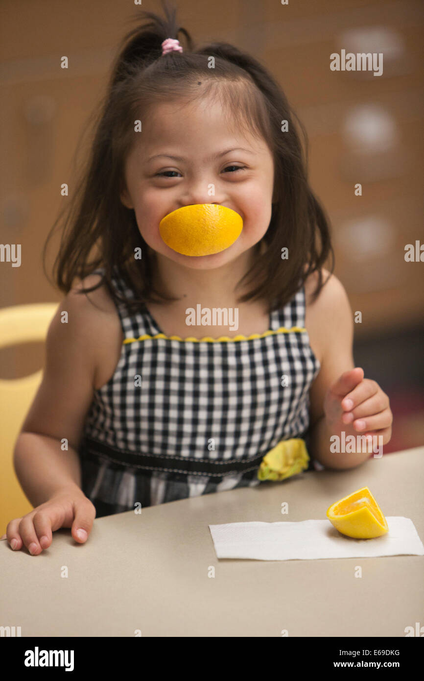 Gemischte Rassen Mädchen mit Down-Syndrom, die Früchte zu essen Stockfoto