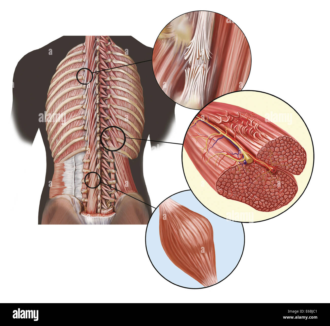 Detail der tiefen Rückenmuskeln mit einer Nahaufnahme von Verstauchung, Dehnung und Krampf. Stockfoto