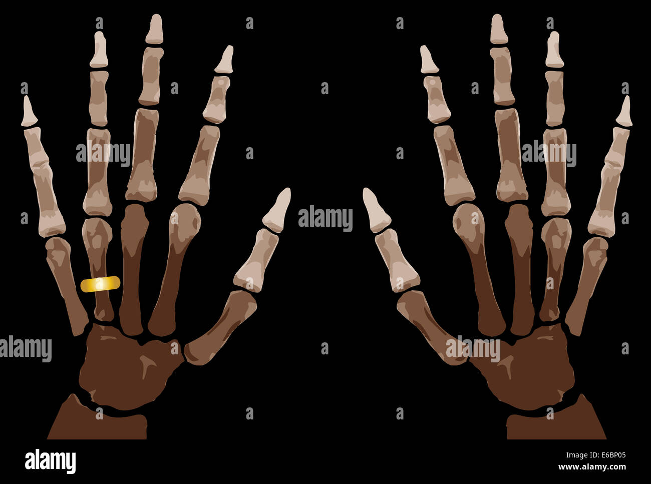 Die Knochen der Hand isoliert auf weißem Hintergrund Stockfoto