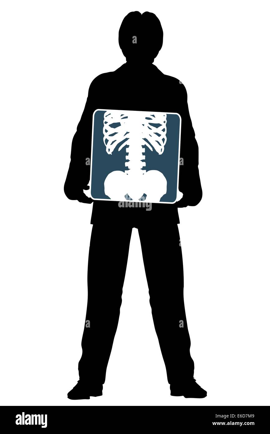 Bearbeitbares Vektor Silhouette eines Mannes hält eine Röntgenaufnahme von seinem Bauch Stock Vektor