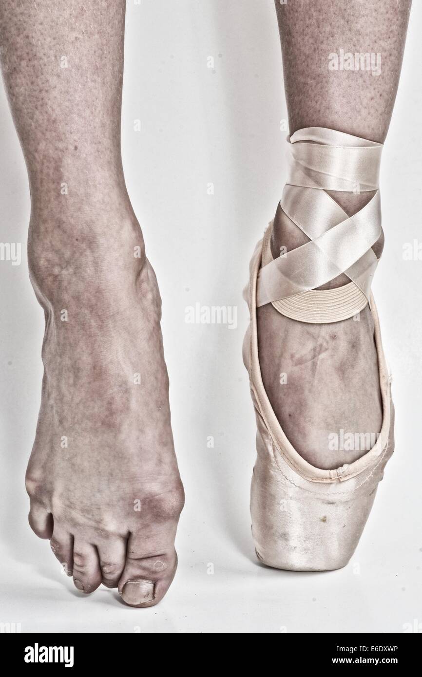 Füße einer Ballerina, eins mit einem Ballett Pointe Schuh und der andere  barfuß Stockfotografie - Alamy