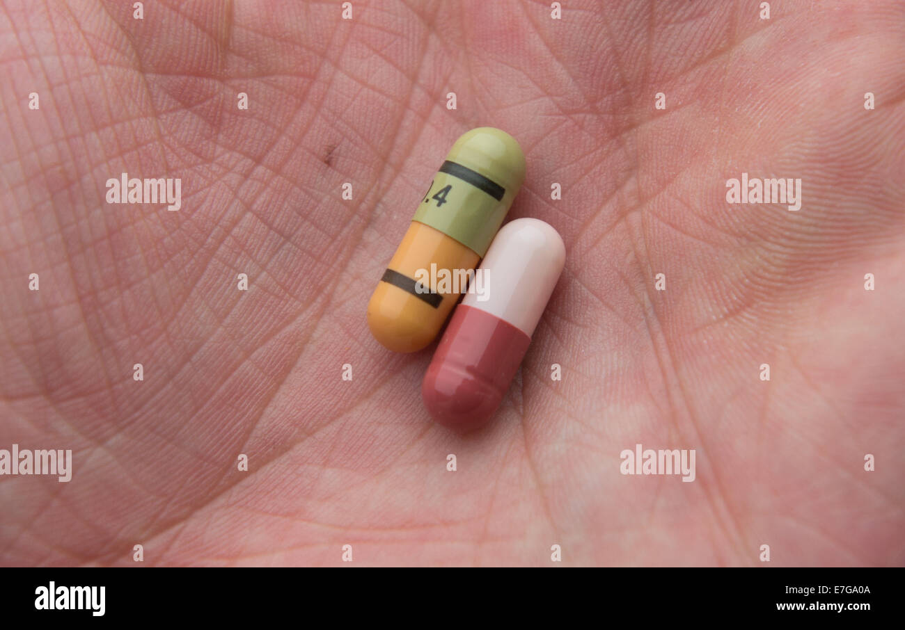 Pillen auf einer menschlichen Hand, 18. August 2014 in Hamburg. Stockfoto