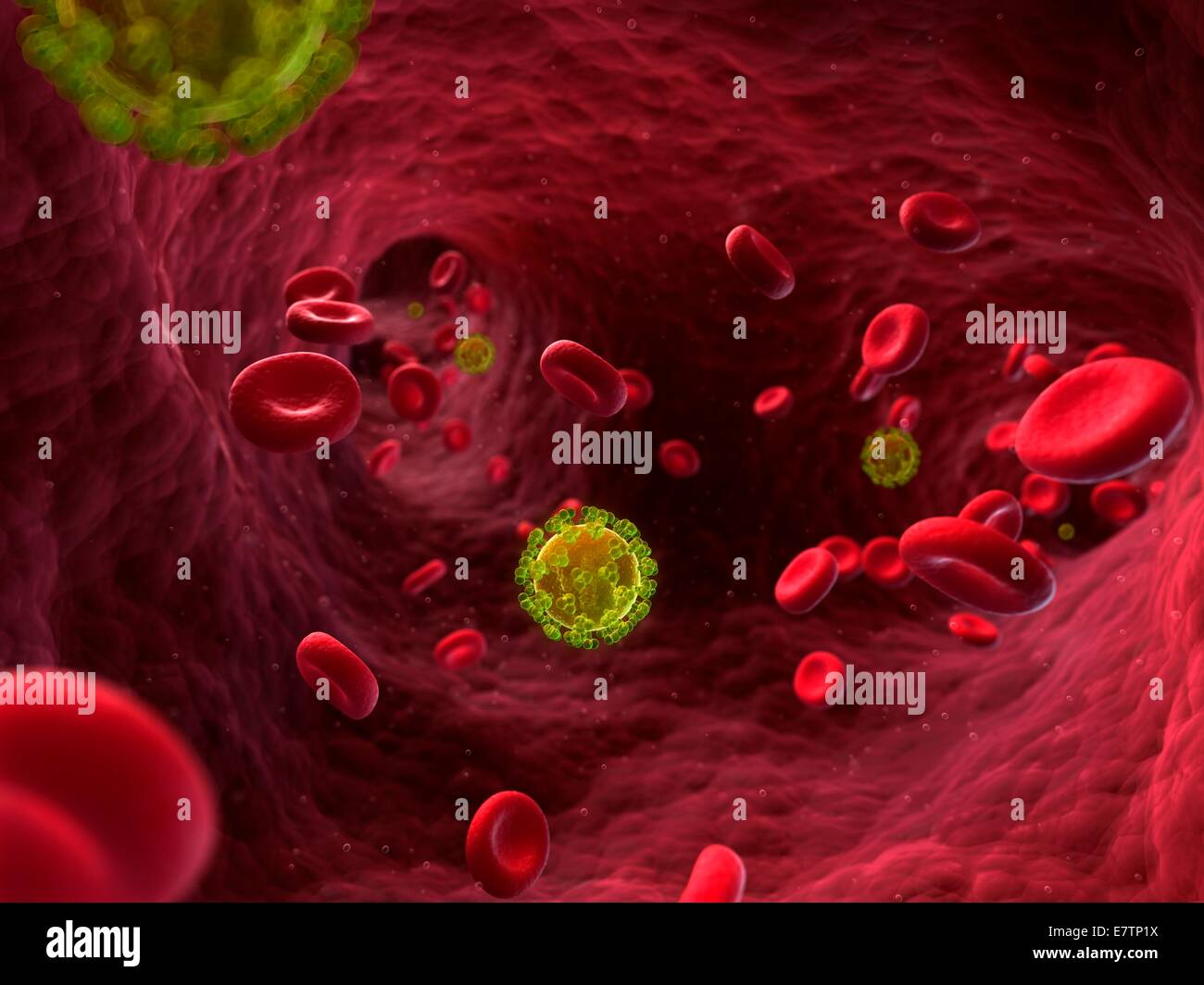 HIV (Human Immunodeficiency Virus) Infektion, Computer-Grafik. Stockfoto