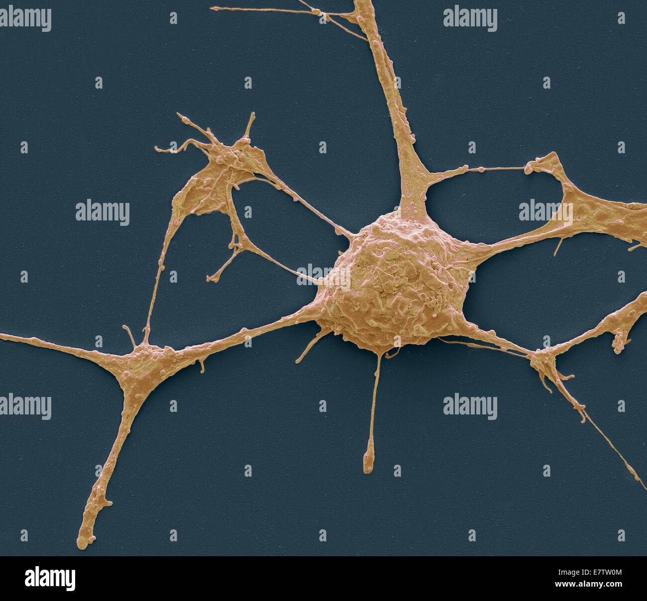 Neurone. Scanning Electron Schliffbild (SEM) von einem PC12 Neurone in Kultur. PC12 Zelllinie, entwickelt von einem Phäochromozytom Tumor von der Ratte Nebennierenmark, ist eine Premiere Modell für die Untersuchung der neuronalen Differenzierung geworden. Wenn Kultur behandelt Stockfoto
