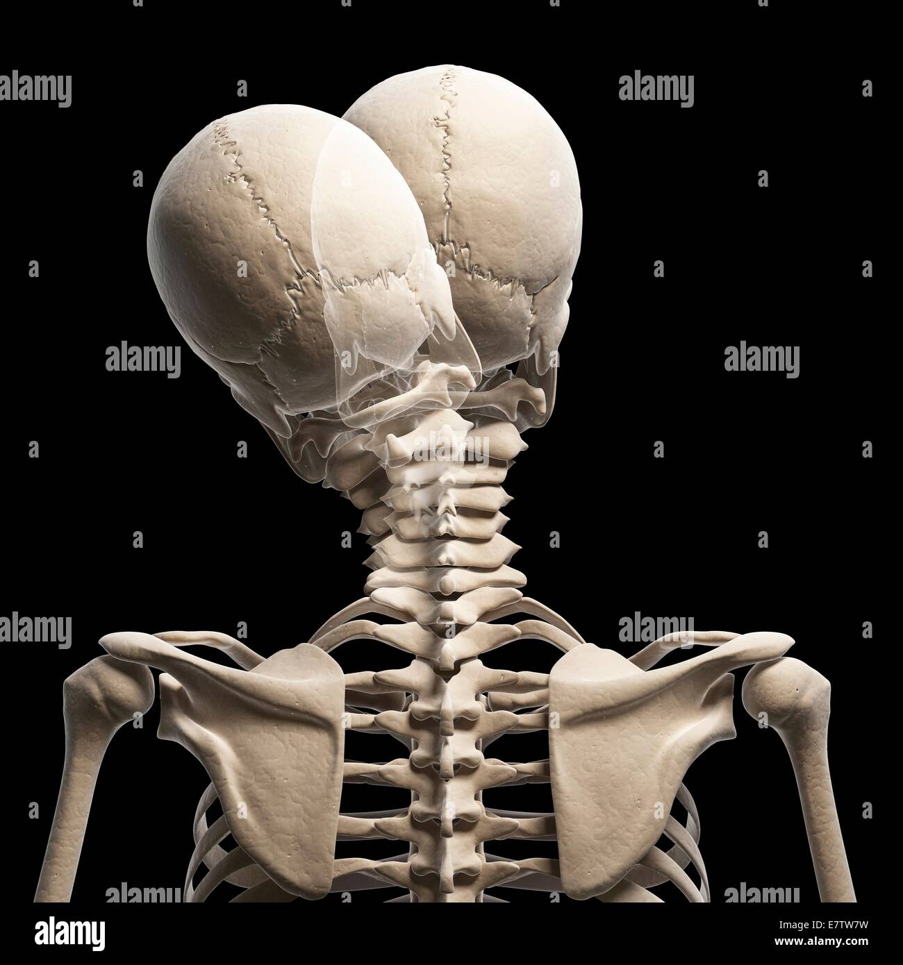 Schädel und Hals Menschenknochen, Computer-Grafik. Stockfoto
