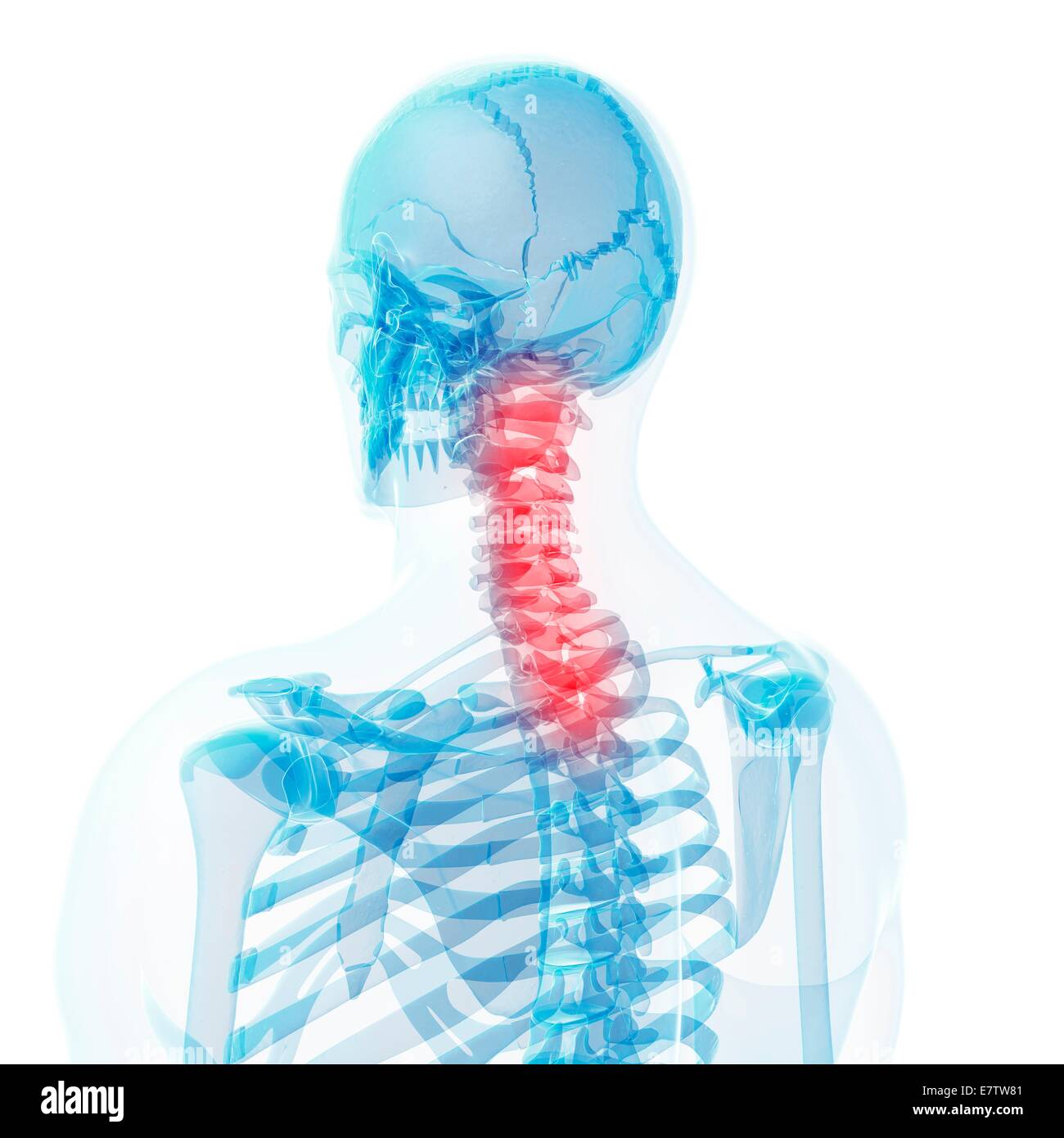 Menschlichen Halswirbelknochen, Computer-Grafik. Stockfoto