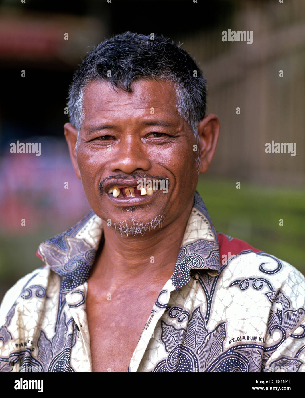 Balinesische Mann lächelnd mit schlechten Zähnen, Zahnverlust, Bali, Indonesien Stockfoto
