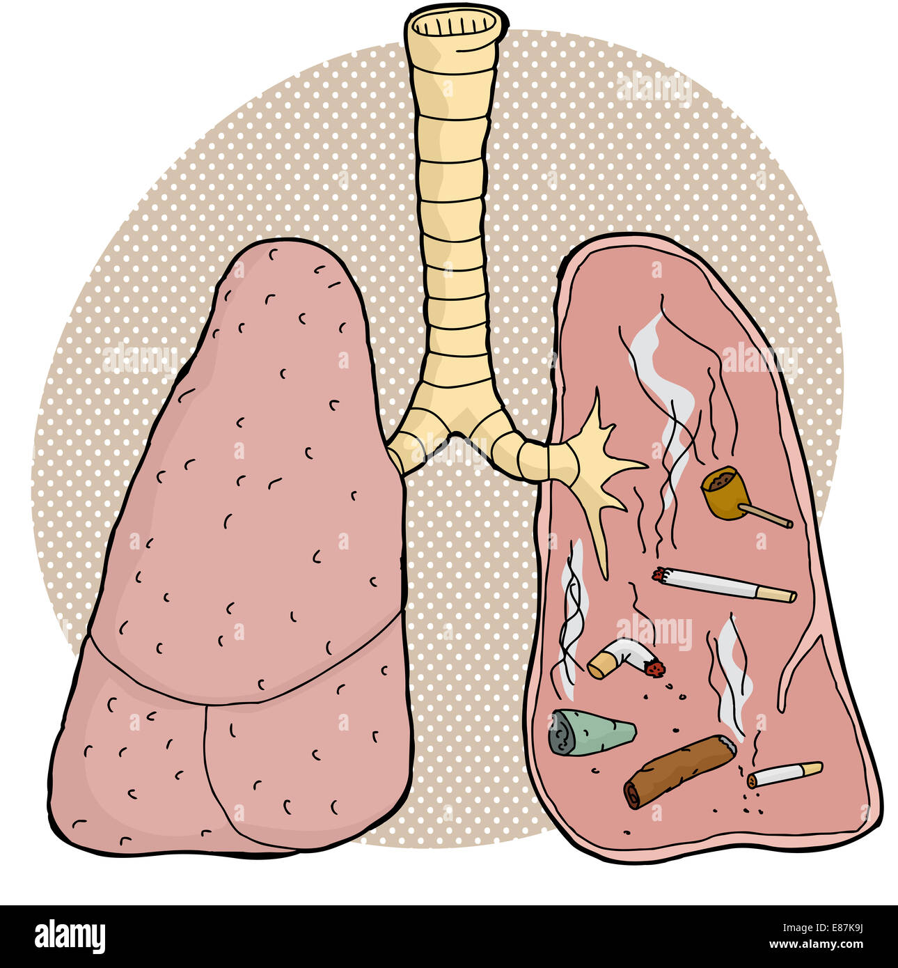 Verschiedene süchtig Tabak Objekte innerhalb der menschlichen Lunge Stockfoto