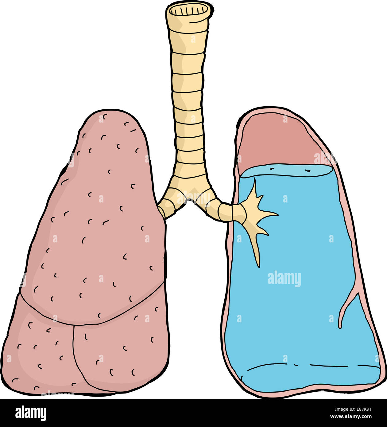 Karikatur von Wasser im menschlichen Lunge Querschnitt Stockfoto