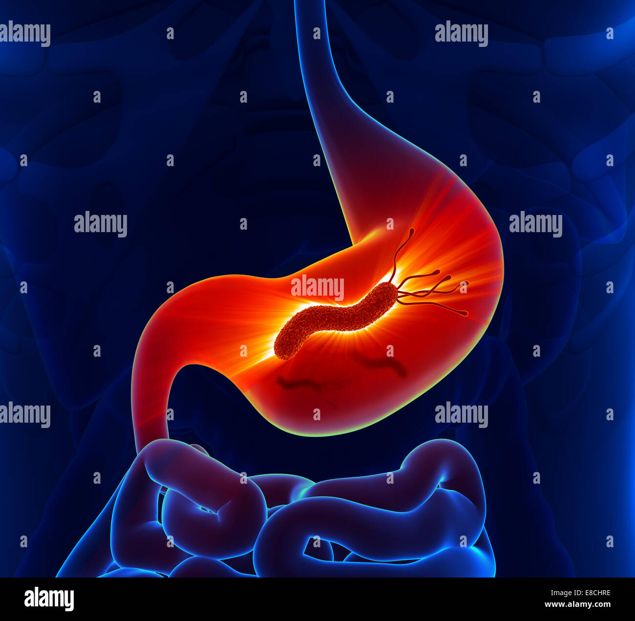 Helicobacter Pylori - Magen Stockfoto