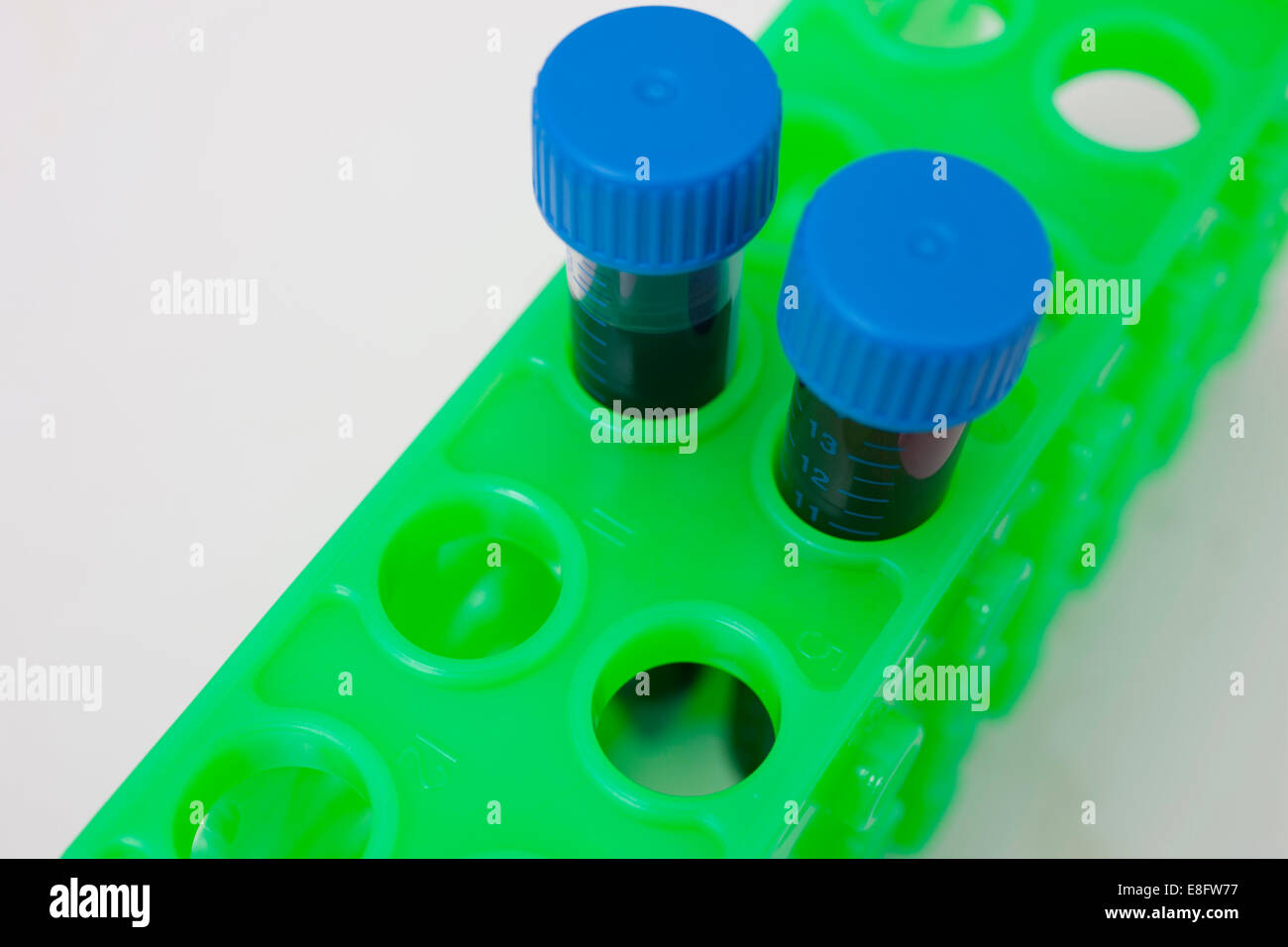 Medizinische Proben im Reagenzglas im Forschungslabor Stockfoto