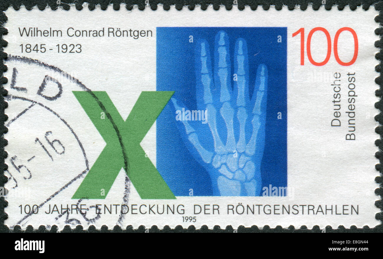 Briefmarke gedruckt in Deutschland, widmet sich der 150. Geburtstag von Wilhelm Conrad Röntgen, Entdecker der Röntgenstrahlen Stockfoto