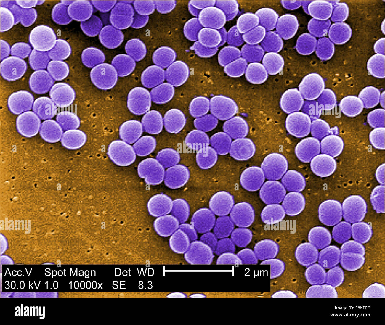 Unter starker Vergrößerung von 10 zeigt 000 X, diese scanning Electron Schliffbild (SEM) Stamm von Staphylococcus Aureus-Bakterien Stockfoto