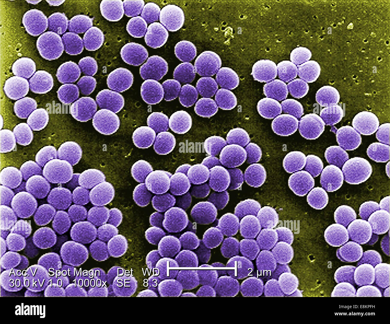 Unter starker Vergrößerung von 10 zeigt 000 X, diese scanning Electron Schliffbild (SEM) Stamm von Staphylococcus Aureus-Bakterien Stockfoto